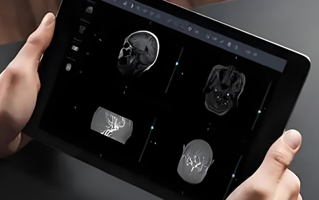 云胶片/激光胶片迈德卫云影像-电子胶片，那雕刻在胶片上的美好时光！