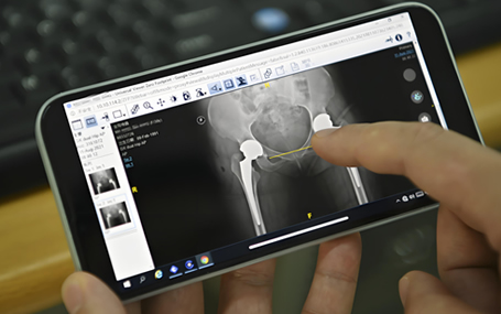 热敏胶片/激光胶片迈德卫影像云-云胶片推动医疗服务质量提升！