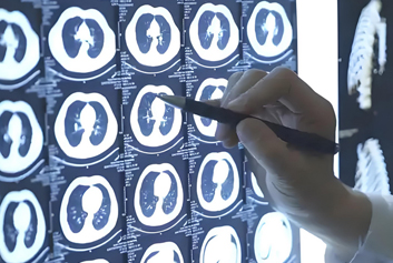 云胶片/电子胶片迈德卫云影像-告别胶片堆！医疗影像迈入无胶片时代，改变的不只是一张片子