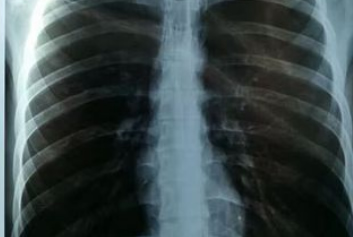 云胶片/超声工作站迈德卫影像云-热敏胶片守护健康的 “诊断好帮手”