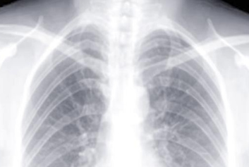 云胶片/热敏胶片迈德卫医疗影像云-影像上云，让健康不再“负重前行”