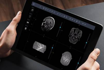 医共体软件/影像云迈德卫医疗-告别“胶片负担”：电子胶片正在重塑我们的就医体验