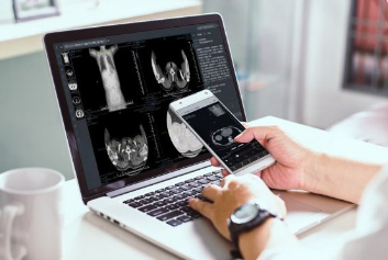 医联体软件/医疗影像云迈德卫医疗-云胶片能存多久？你不知道的事！