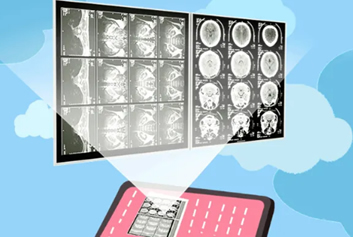 医联体软件/医共体软件迈德卫医疗影像云-云胶片市场前景如何？那些我们不知道的事！