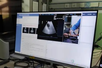 医联体软件/超声工作站迈德卫医疗影像云-远程诊断让偏远地区不再“看病难”